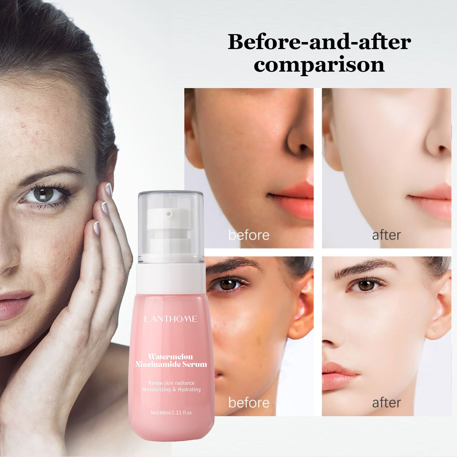 Watermelon Glow Niacinamide Moisturizing Face Pre-Treatment,Moisturizing Serum,Skin Makeup Lightweight Moisturizing Pre-treatmen